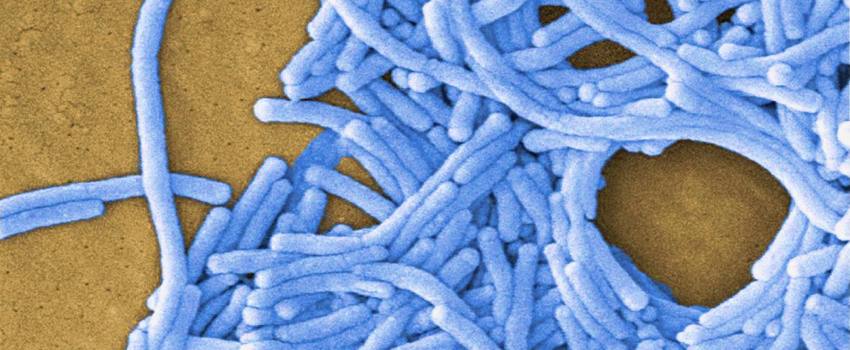 Nebulizzazione - Legionella Pneumophila